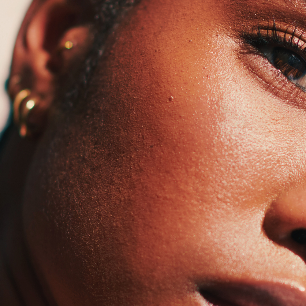 Close-up of a person's face with a focus on the skin texture.
