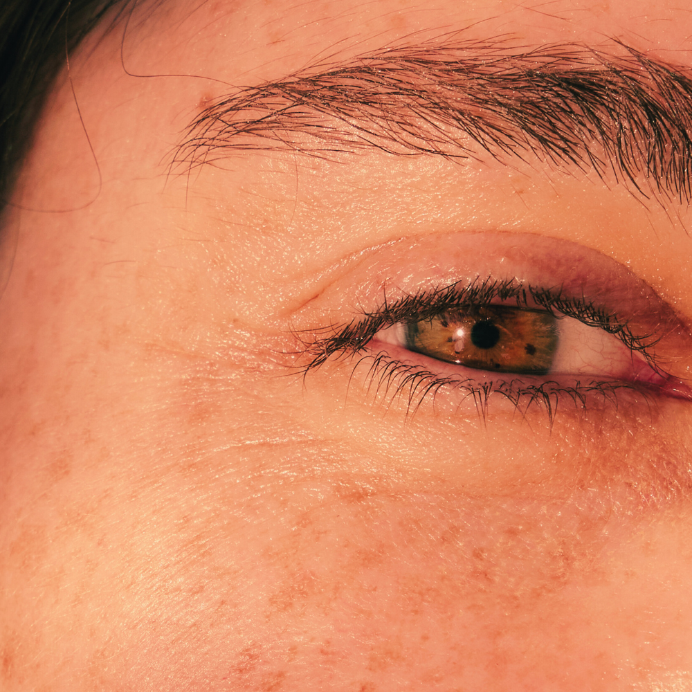 Close-up of a person's eye with detailed skin texture.